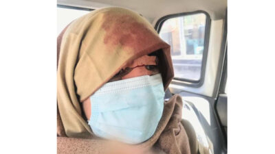 Αφγανή διαδηλώτρια μετά τον τραυματισμό της από τις κυβερνητικές δυνάμεις των Ταλιμπάν - 28/12/2021