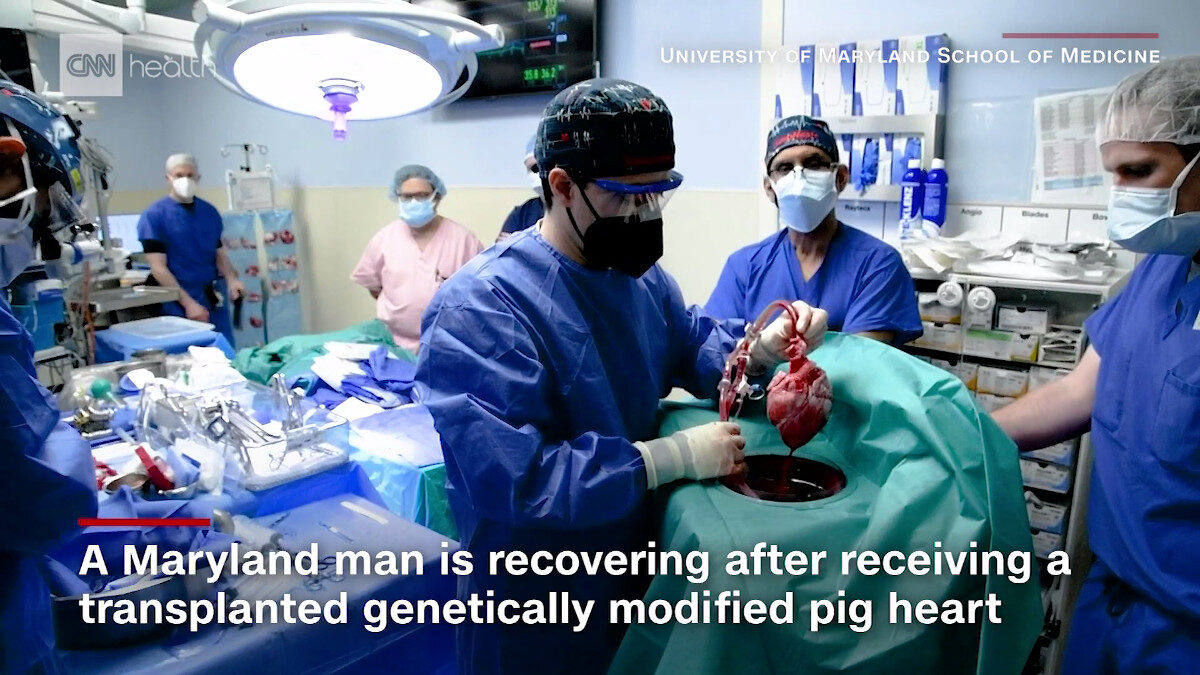 Μεταμόσχευση καρδιάς ενός γενετικά τροποποιημένου χοίρου σε 57χρονο Αμερικανό