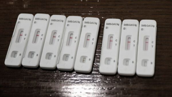 Κορονοϊός: 6.289 νέα κρούσματα - 19 νέοι θάνατοι - 120 οι διασωληνωμένοι