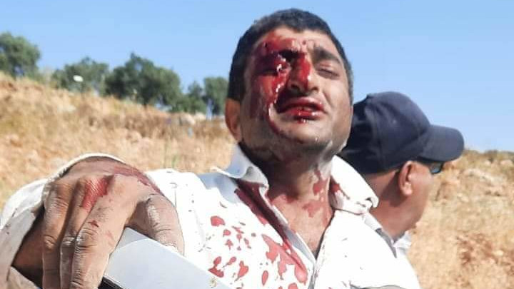 Τραυματισμένος παλαιστίνιος αγρότης από επίθεση Ισραηλινών εποίκων στην Turmus Ayya